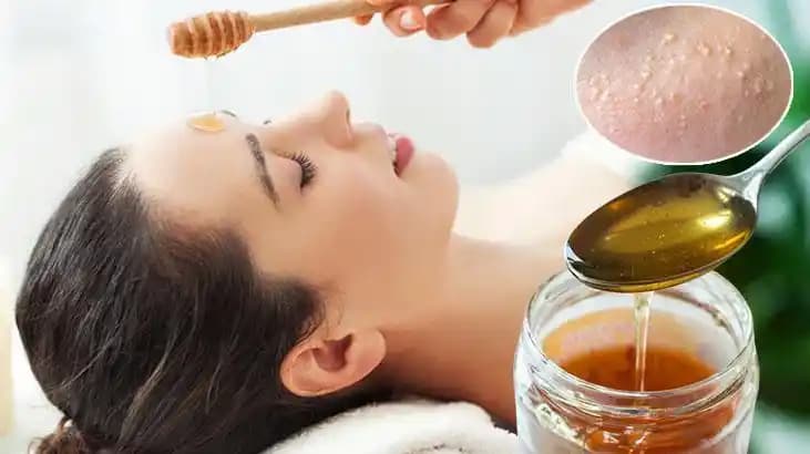 Yüzdeki Beyaz Noktalar İçin En Etkili Krem ve Doğal Tedavi Yöntemleri