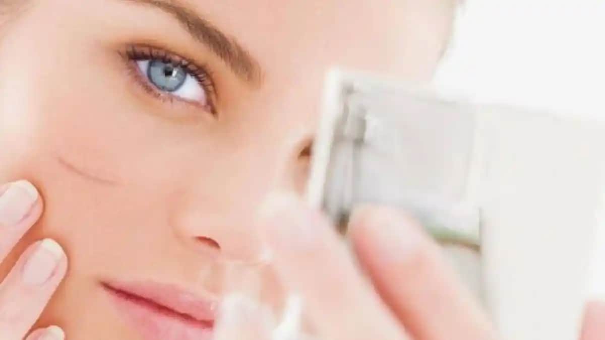 Yüzdeki Dikiş İzlerini Azaltan Etkili Yöntemler ve Doğal Çözümler