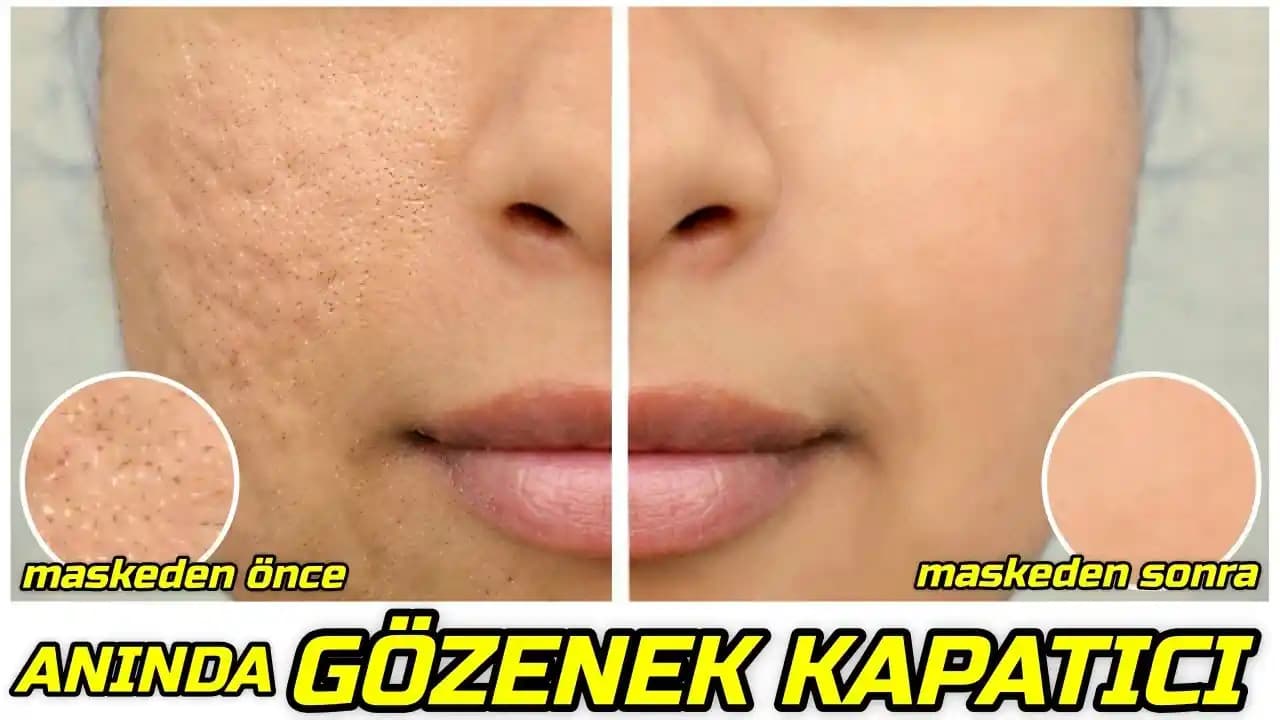 Yüzdeki Gözenekleri Küçültmek İçin Evde Uygulanabilir Etkili Yöntemler ve Bakım Tavsiyeleri