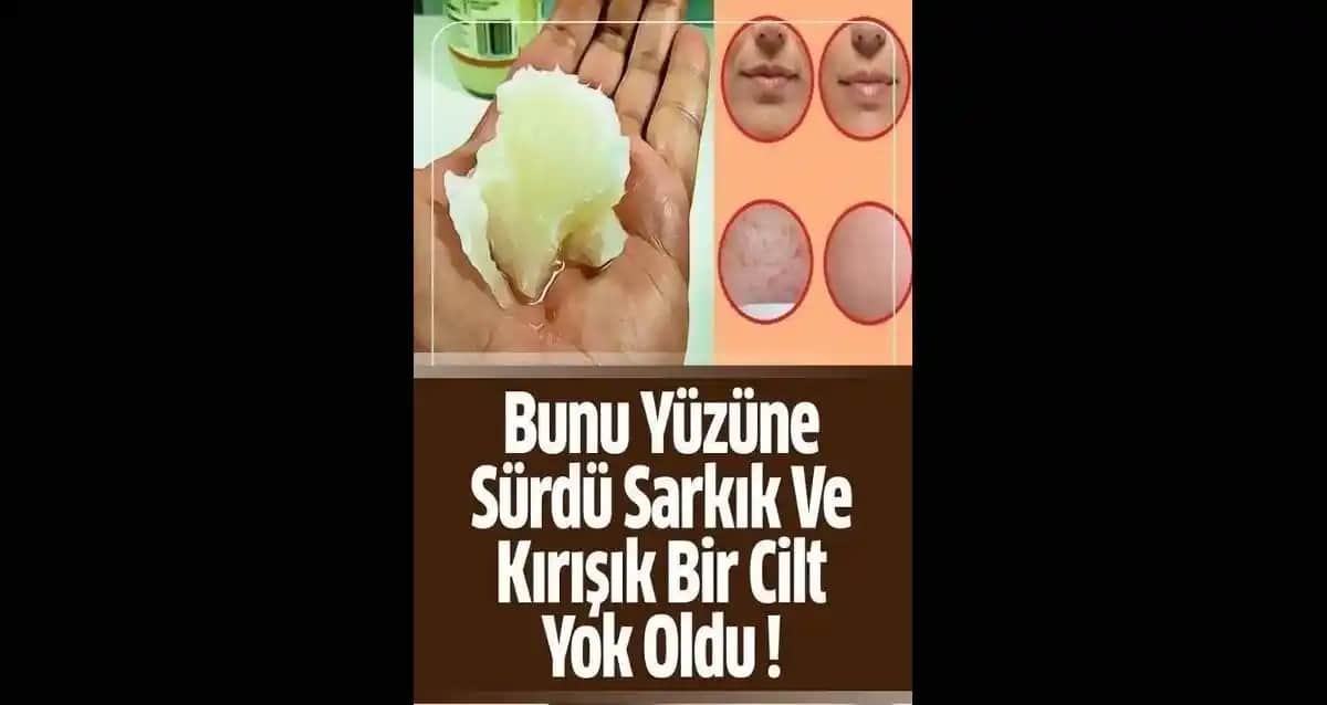 Yüzdeki Kabukların Nedenleri ve Etkili Çözüm Yöntemleri