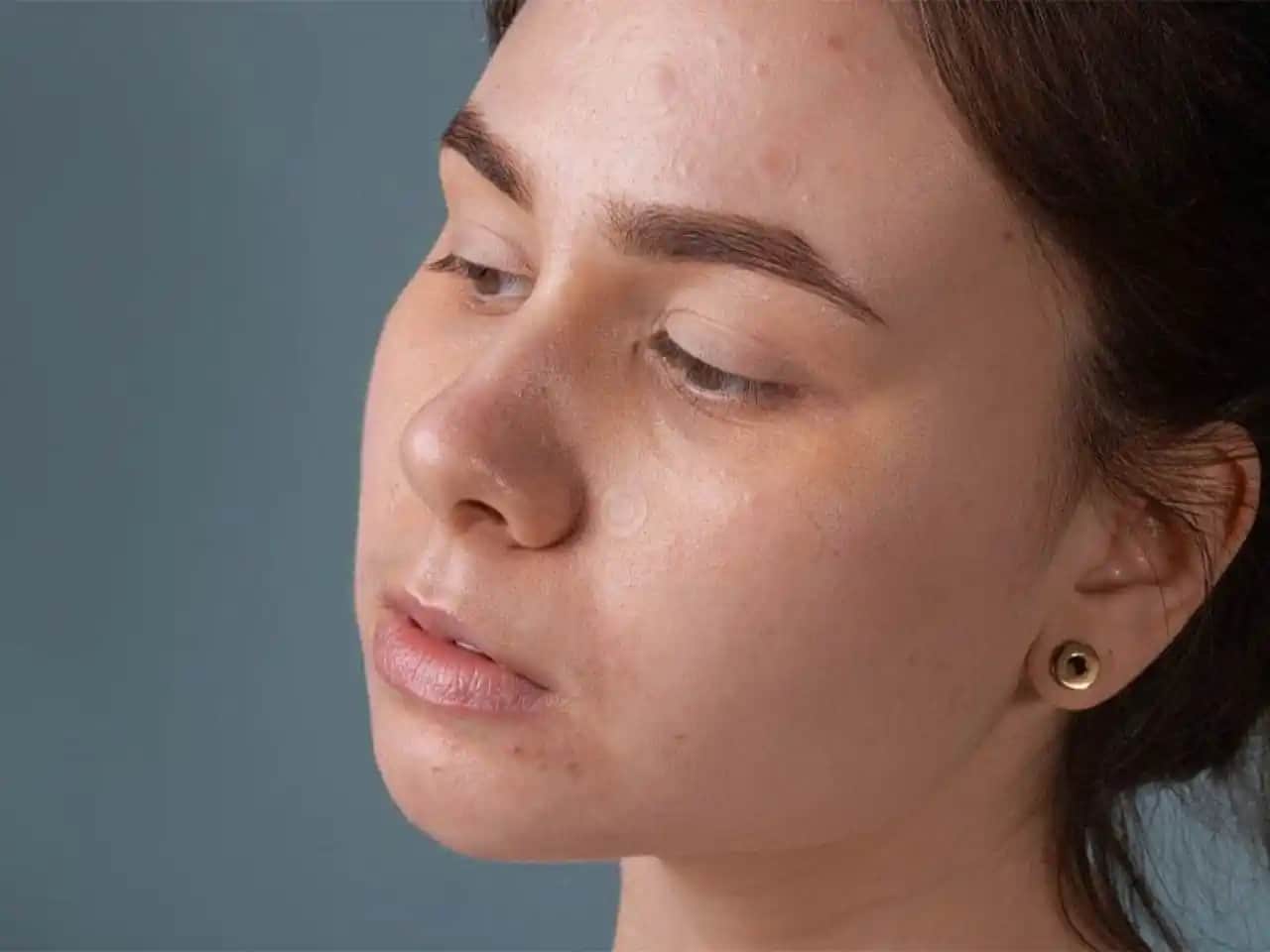 Yüzdeki Kızarıklık ve Lekeleri Gidermenin Etkili Yöntemleri ve Bakım İpuçları