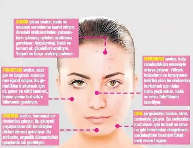 Yüzdeki Minik Sivilcelerin Nedenleri ve Etkili Çözüm Yolları