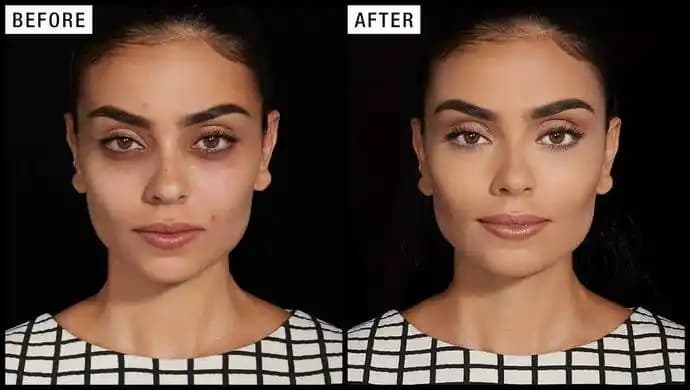 Yüzdeki Renk Eşitsizliği Nasıl Giderilir: Kozmetik ve Doğal Çözümler