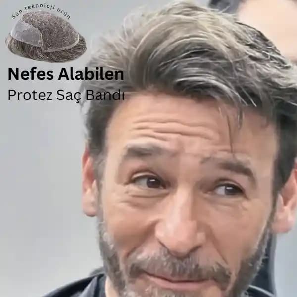 Protez Saç Bandı Seçiminde Malzeme, Esneklik ve Konforun Önemi