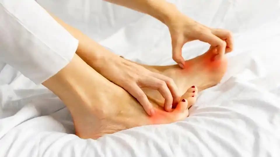 Ayakta Koku Nedenleri ve Etkili Çözüm Yolları Hakkında Bilmeniz Gerekenler