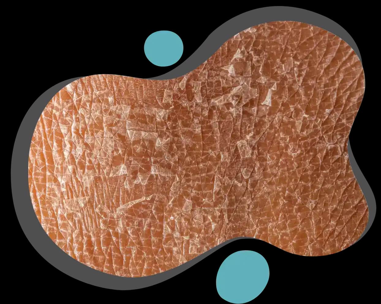 Bacak Kuruluğu Nedenleri ve Etkili Çözüm Yolları Hakkında Bilgiler