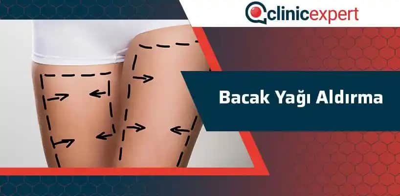 Bacak Yağı Nedir, Neden Oluşur ve Etkili Müdahale Yöntemleri Nelerdir