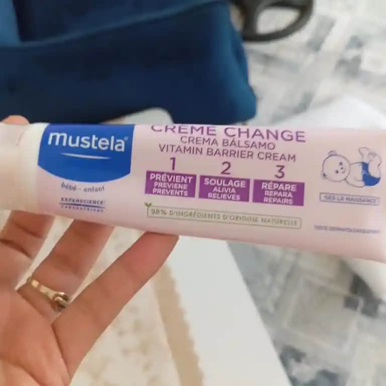 Bebek Sivilcesi ve En Uygun Kremler: Bebek Bakımında Doğru Yaklaşım