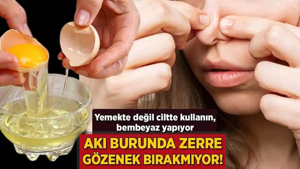 Burunda Gözenekleri Temizleme ve Sağlıklı Tutma Yöntemleri