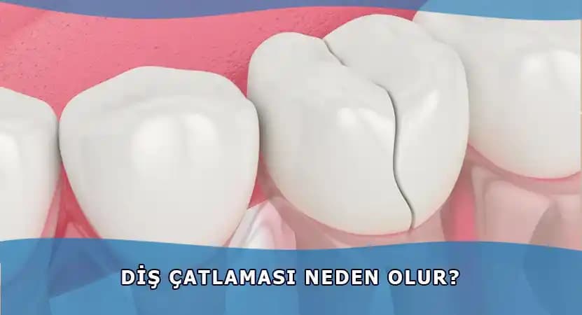 Çatlakların Oluşumu, Nedenleri ve Cilt Sağlığını Koruma Yöntemleri