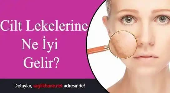 Cilt Lekelerine Karşı Etkili Çözüm Yöntemleri ve Bakım İpuçları