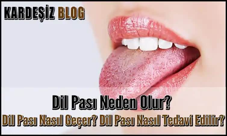 Dil Pası Nedir ve Nasıl Temizlenir Sağlıklı Gülüş İçin Önemli İpuçları