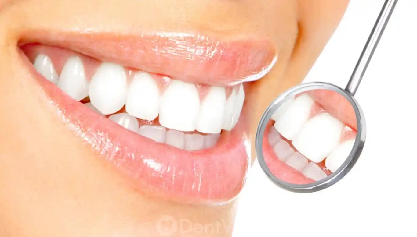 Diş Beyazlatma Yöntemleri ve En Uygun Seçenekler Hakkında Detaylı Bilgi