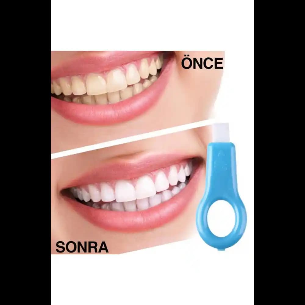 Diş Lekeleriyle Mücadele Yolları ve Etkili Leke Giderici Ürünler Rehberi