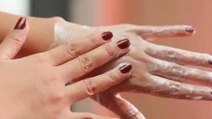 El Çatlağına Karşı Etkili Yöntemler ve Cilt Sağlığını Koruma İpuçları