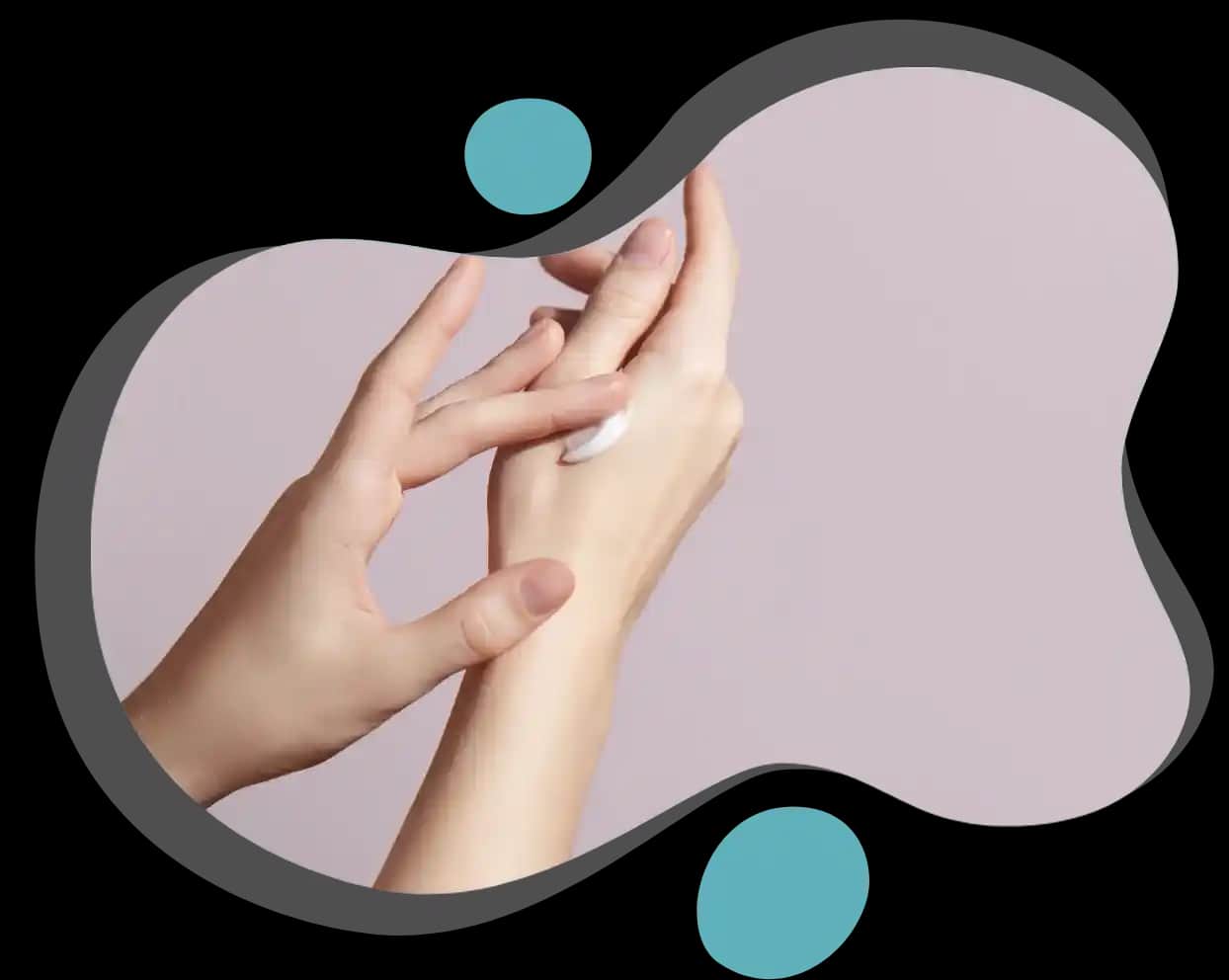 El Çatlaması ve Kanaması İçin Etkili Bakım Yöntemleri ve Doğal Çözümler