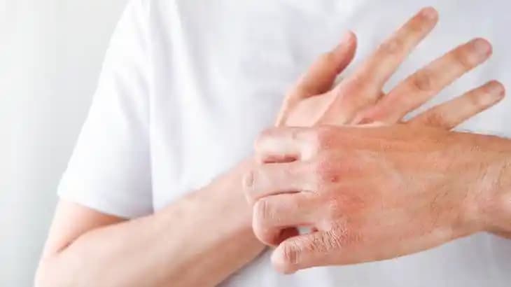 El Tahrişine Karşı En Etkili Bakım Yöntemleri ve Doğal Çözümler