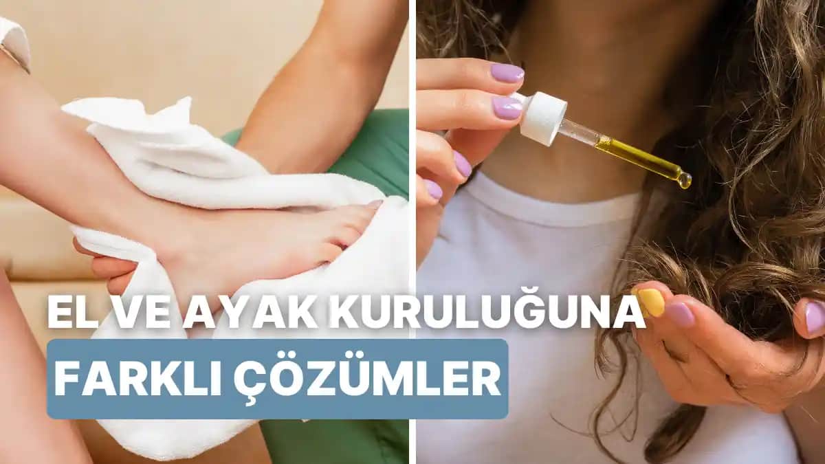 Elde Kuruluğa Karşı Etkili ve Doğal Çözüm Yöntemleri ve Bakım Tavsiyeleri