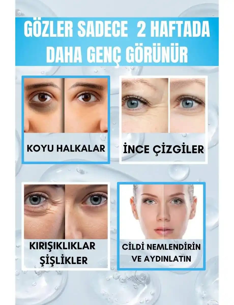 Göz Altı Kırışıklıklarına Karşı Etkili Bakım Yöntemleri ve Doğal Çözümler