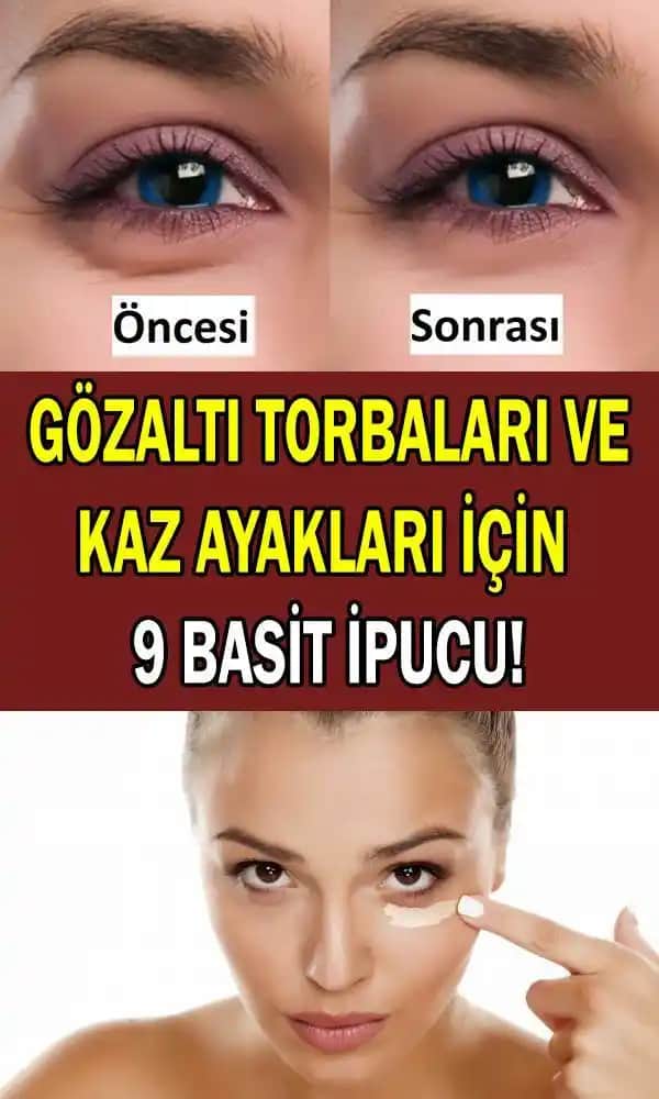 Göz Altı Noktalarını Azaltmak İçin Etkili Yöntemler ve Bilimsel Tavsiyeler