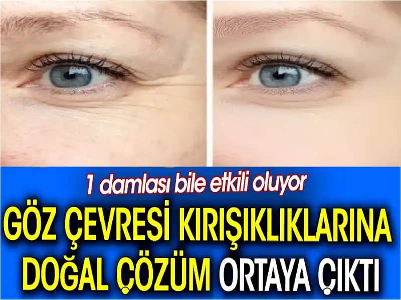 Göz Çevresi Kuruluğu İçin Doğal Çözümler ve Bakım İpuçları