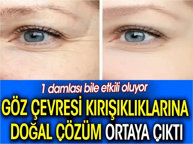 Göz Çevresi Kuruluğu İçin Doğal Çözümler ve Bakım İpuçları