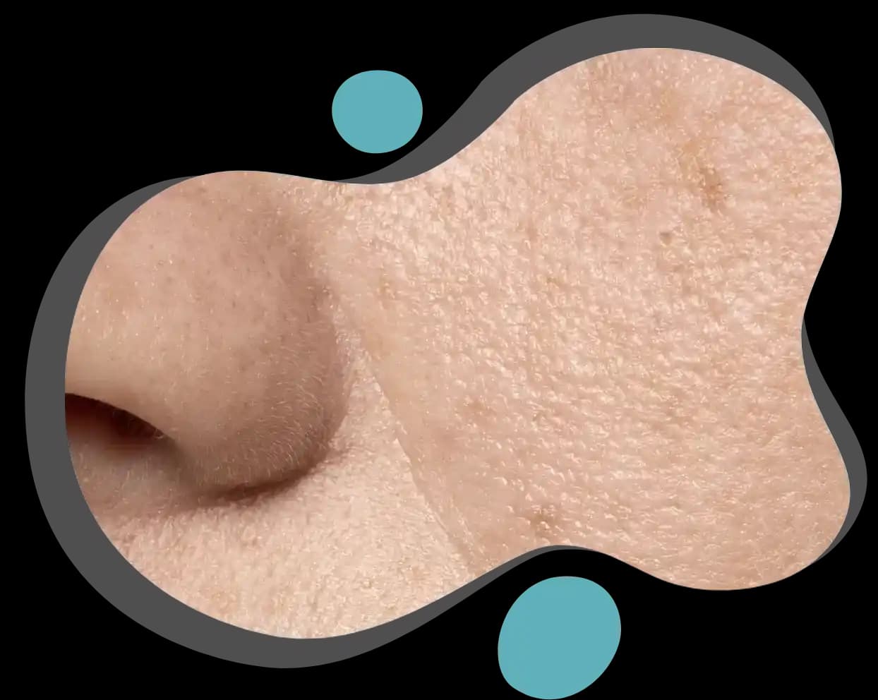 Gözeneklerin Sağlıklı ve Pürüzsüz Görünümünü Koruma Yöntemleri ve İpuçları