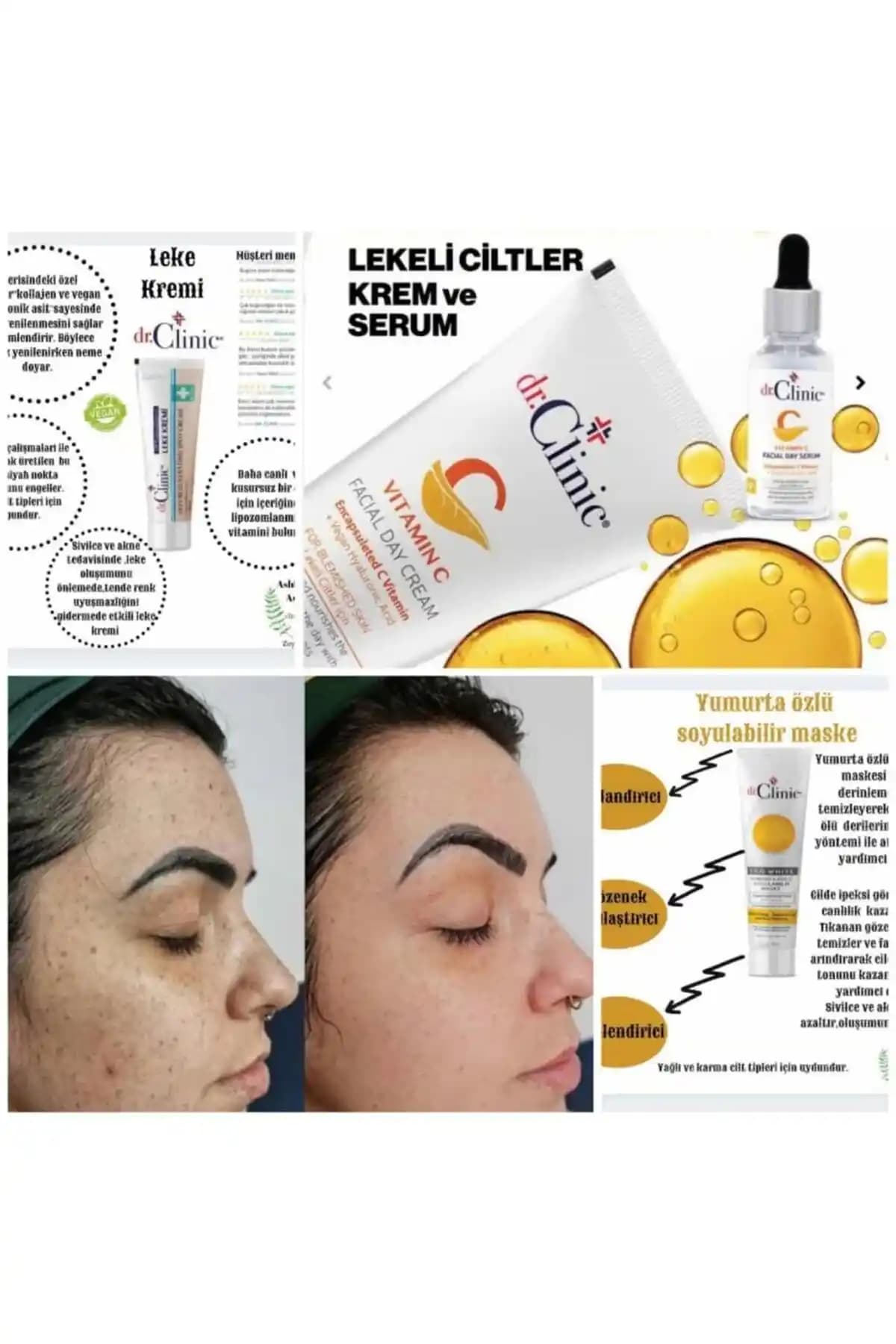 Jweel Leke Kremi: Ciltteki Lekeleri Azaltan Güçlü Çözüm ve Kullanım İpuçları