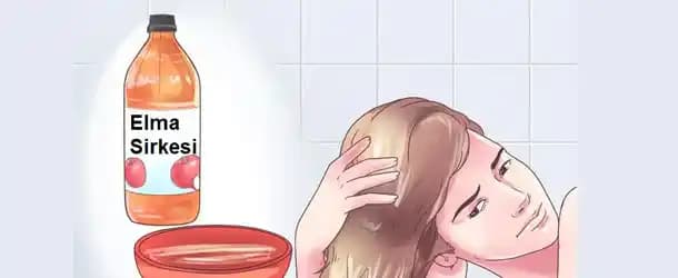 Kepeğe Karşı Doğal Çözüm: Sirkenin Saç Sağlığına Etkileri ve Kullanım Yöntemleri