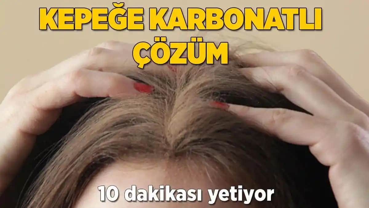 Kepeğe Karşı Etkili Yöntemler ve Saç Sağlığını Koruma İpuçları