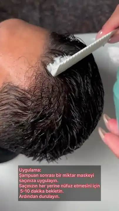 Kepek Sorunu ve Saç Sağlığını Koruma Yöntemleri Detaylı Rehber