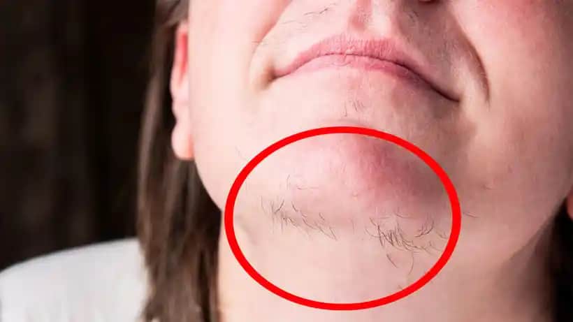 Kılları Kökten Yok Etme Yöntemleri: Etkili ve Güvenli Kalıcı Çözümler