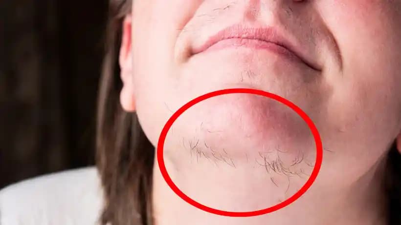 Kılları Kökten Yok Etme Yöntemleri: Etkili ve Güvenli Kalıcı Çözümler