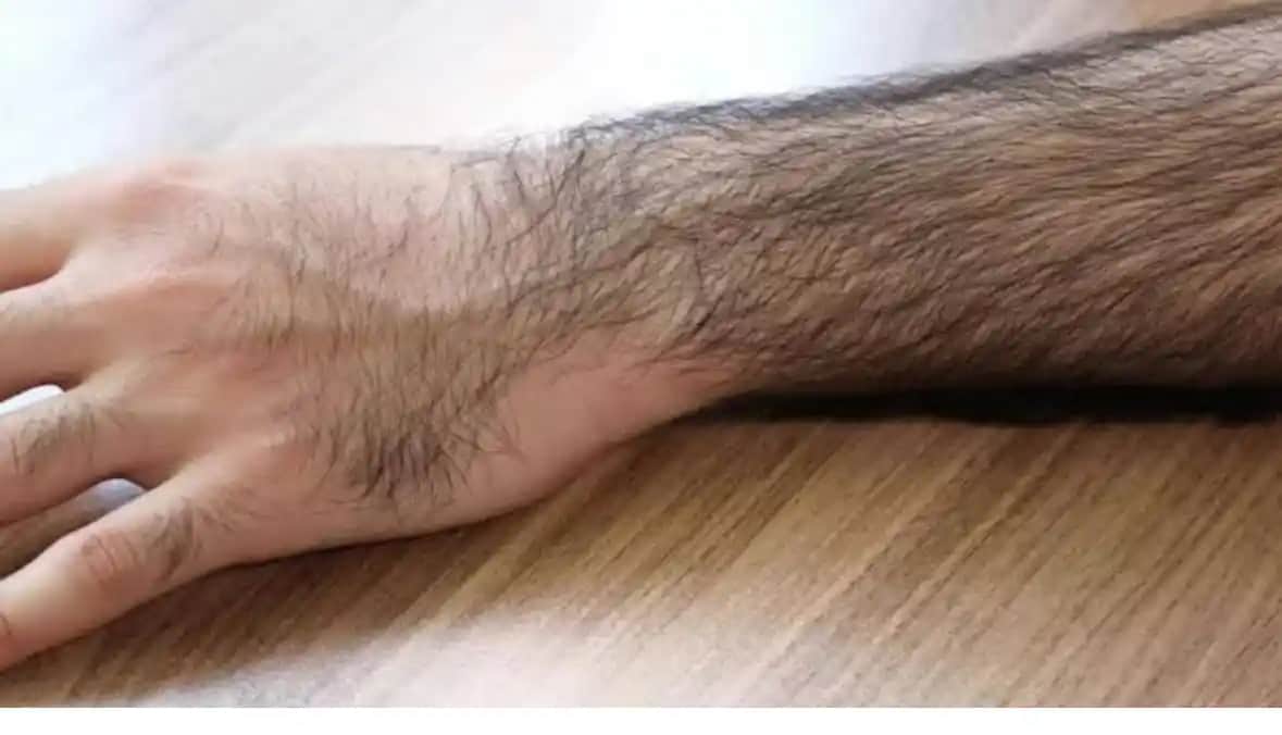 Kol Kıllarını Tüy Dökücüyle Almak: Güvenli ve Etkili Yöntemler Hakkında Bilgiler