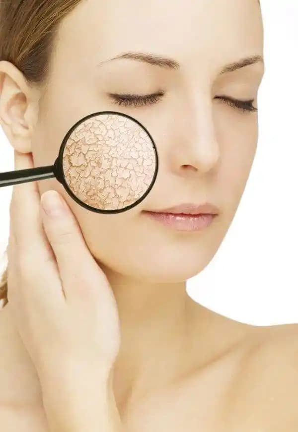 Kuru Ciltler İçin Etkili Bakım Yöntemleri ve Güncel İpuçları