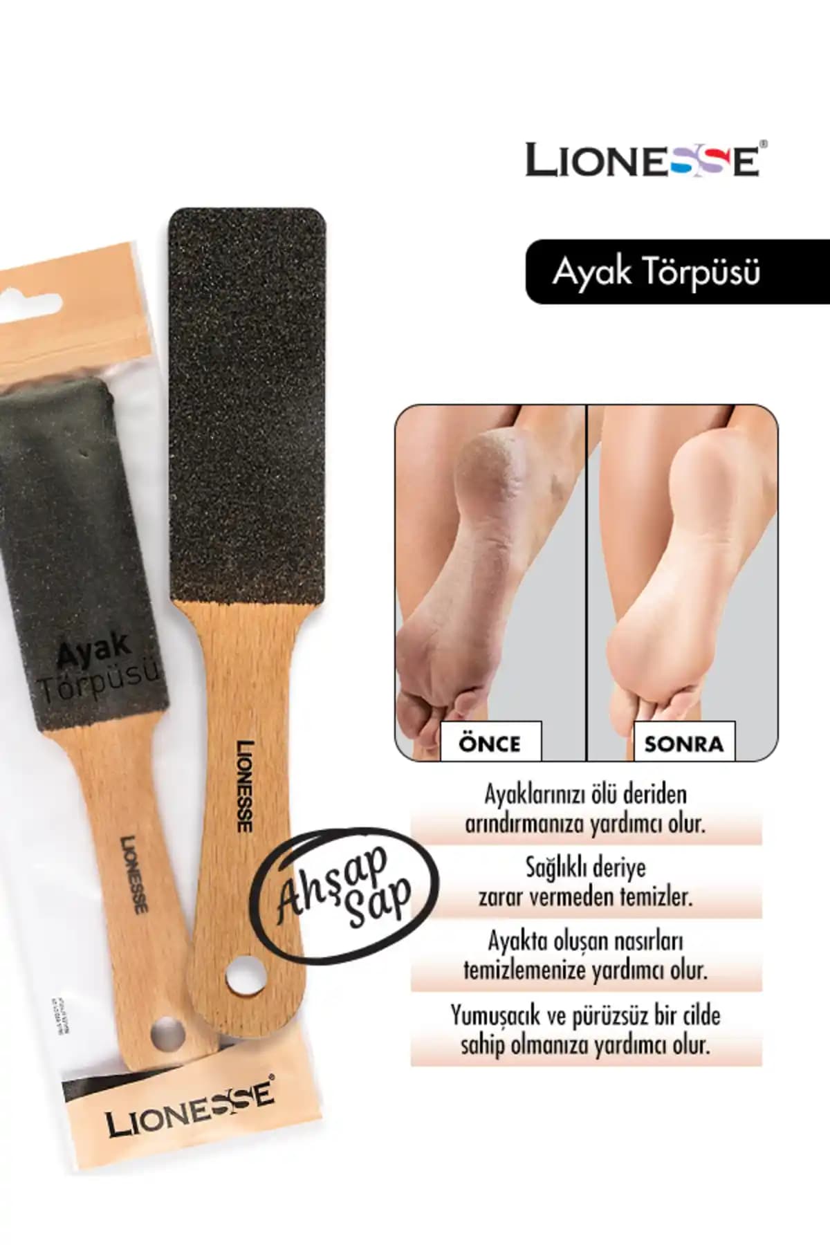 Lionesse Ayak Törpüsü ve Ayak Sağlığı Üzerindeki Etkileri Hakkında Bilgi