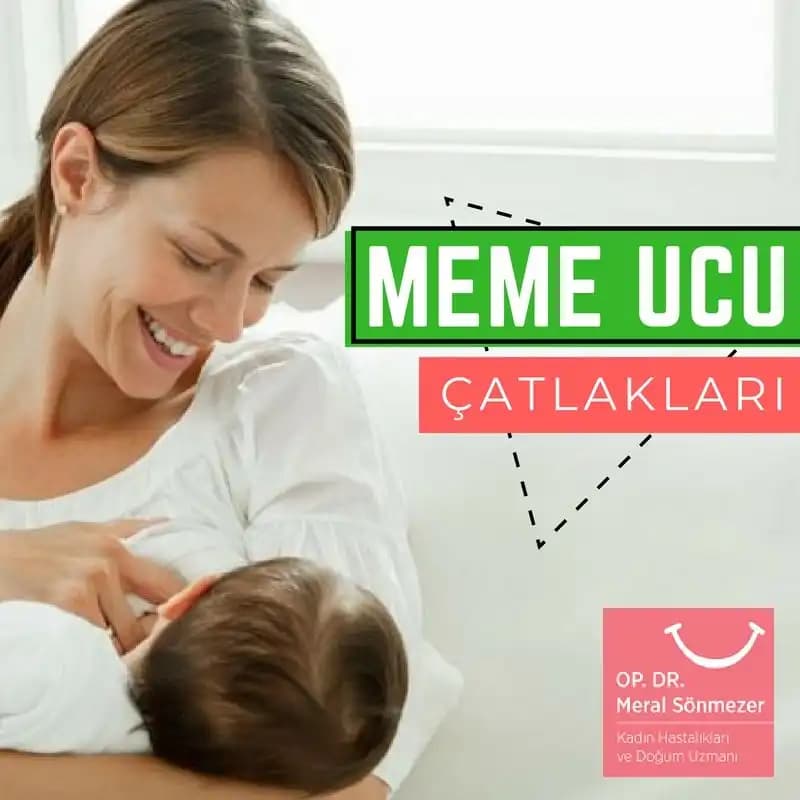 Meme Baş Çatlakları Nedenleri ve Etkili Tedavi Yöntemleri Hakkında Bilgiler