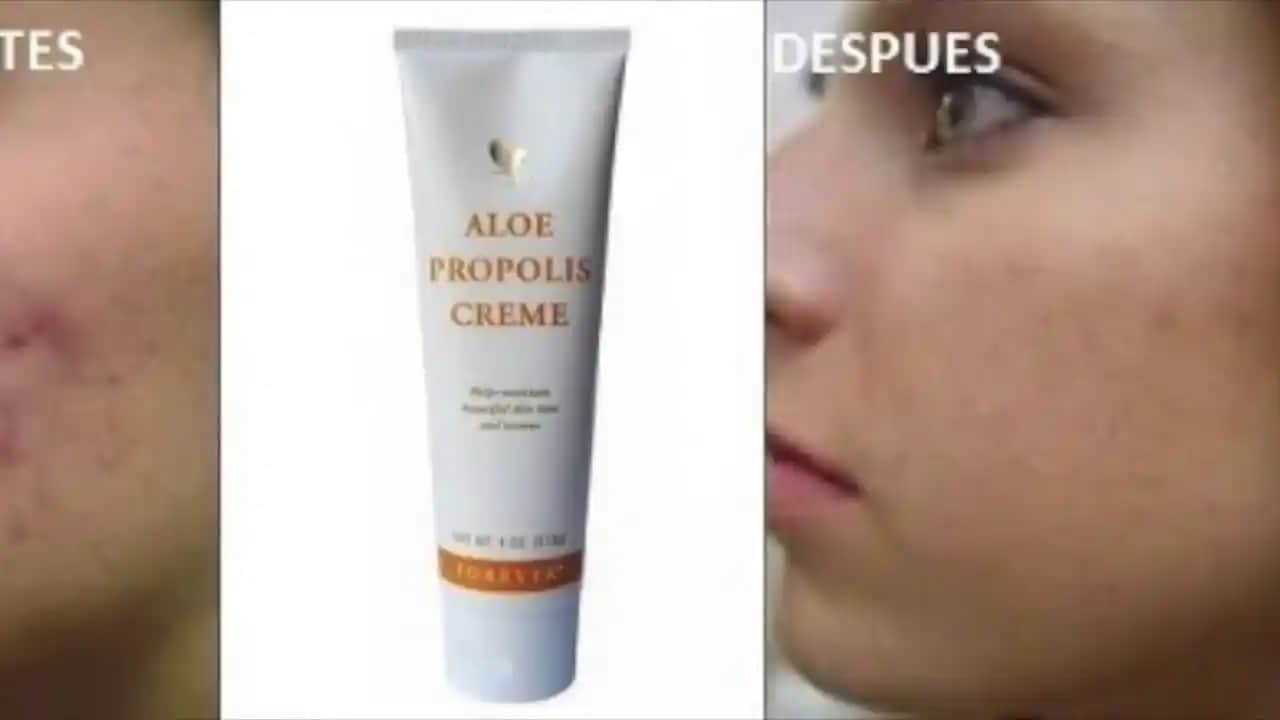 Propolis ve Sivilce: Doğal Bir Çözüm Mü? Cilt Sağlığında Kullanım ve Faydaları