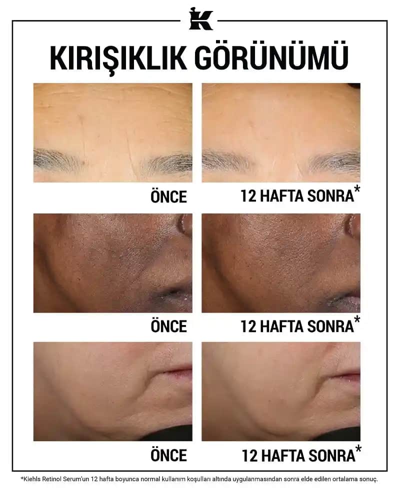 Retinol Nedir ve Cilt Bakımında Nasıl Etkili Kullanılır