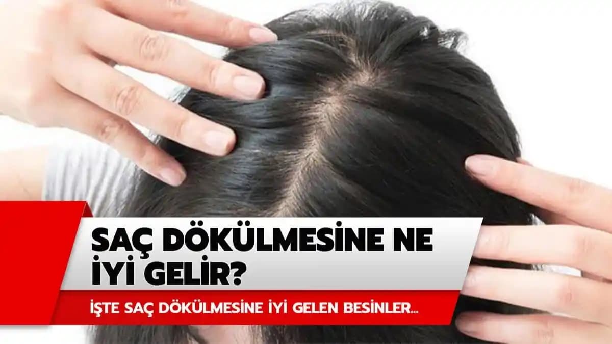 Saç Derisi Dökülmesine Karşı Etkili Yöntemler ve Doğal Çözümler Rehberi