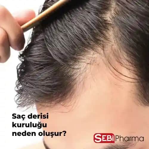 Saç Derisi Kuruluğu Nasıl Giderilir: Etkili Bakım ve Doğal Çözüm Yöntemleri