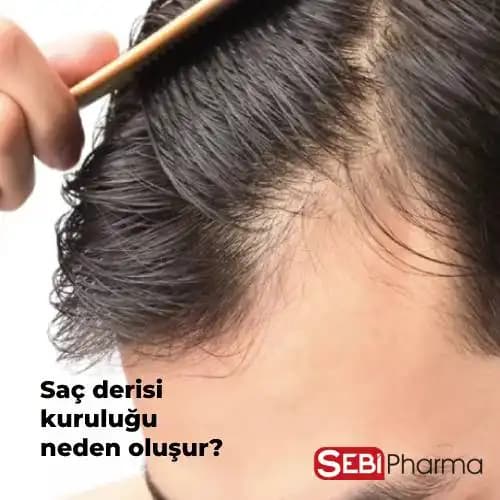 Saç Dibi Kuruluğu Nedenleri, Belirtileri ve Etkili Çözüm Yöntemleri