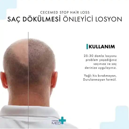 Saç Dökülmesine Karşı Etkili CeceMed Losyonu Saç Sağlığını Güçlendiren Çözüm