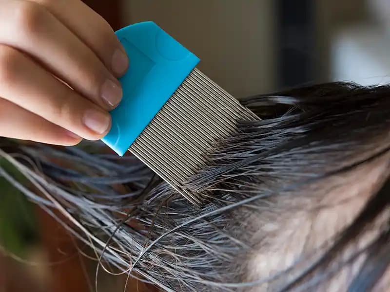 Saçtaki Biti Temizleme Yöntemleri ve Etkili Doğal Çözüm Tavsiyeleri