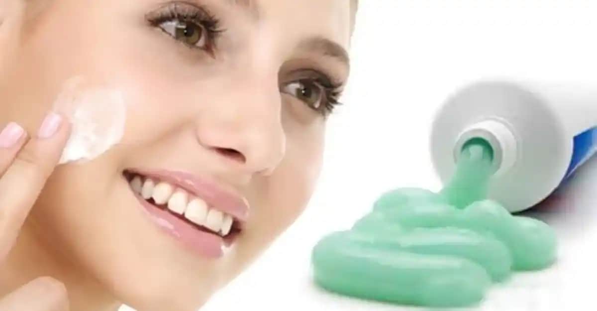 Sivilceye Diş Macunu İyi Gelir mi? Bilmeniz Gerekenler ve Güvenilir Yöntemler