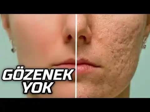 Yüzdeki Gözenekleri Kapama ve Sıkılaştırma Yöntemleri: Doğal ve Profesyonel Çözümler