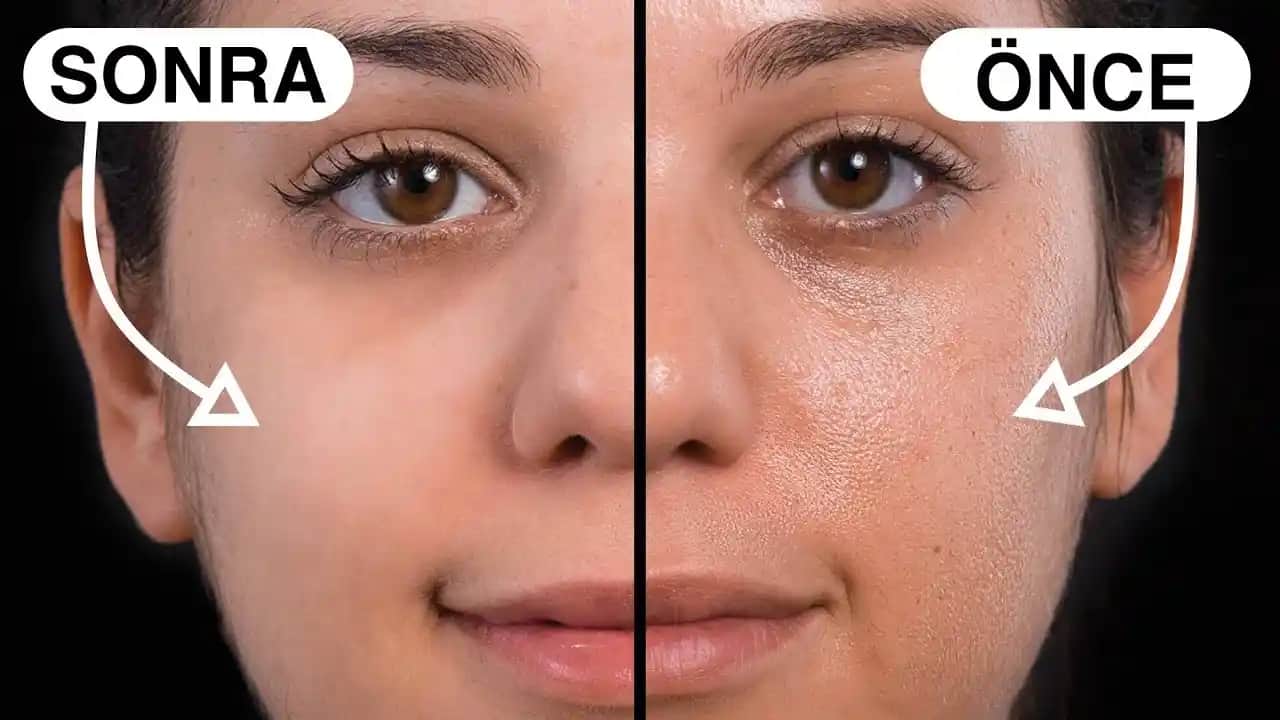 Yüzdeki Gözenekleri Küçültmek ve Sağlıklı Bir Cilt İçin Etkili Yöntemler