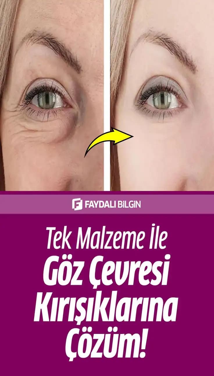 Zeytinyağıyla Göz Altı Kırışıklıklarına Karşı Doğal ve Güvenli Çözüm Yöntemleri