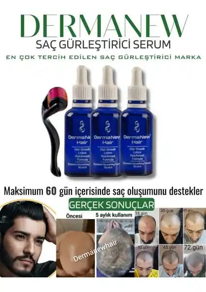 DermaNew Saç Losyonu: Dökülmeye Karşı Doğal İçerikler ve Argan Kokusuyla Etkili Bakım