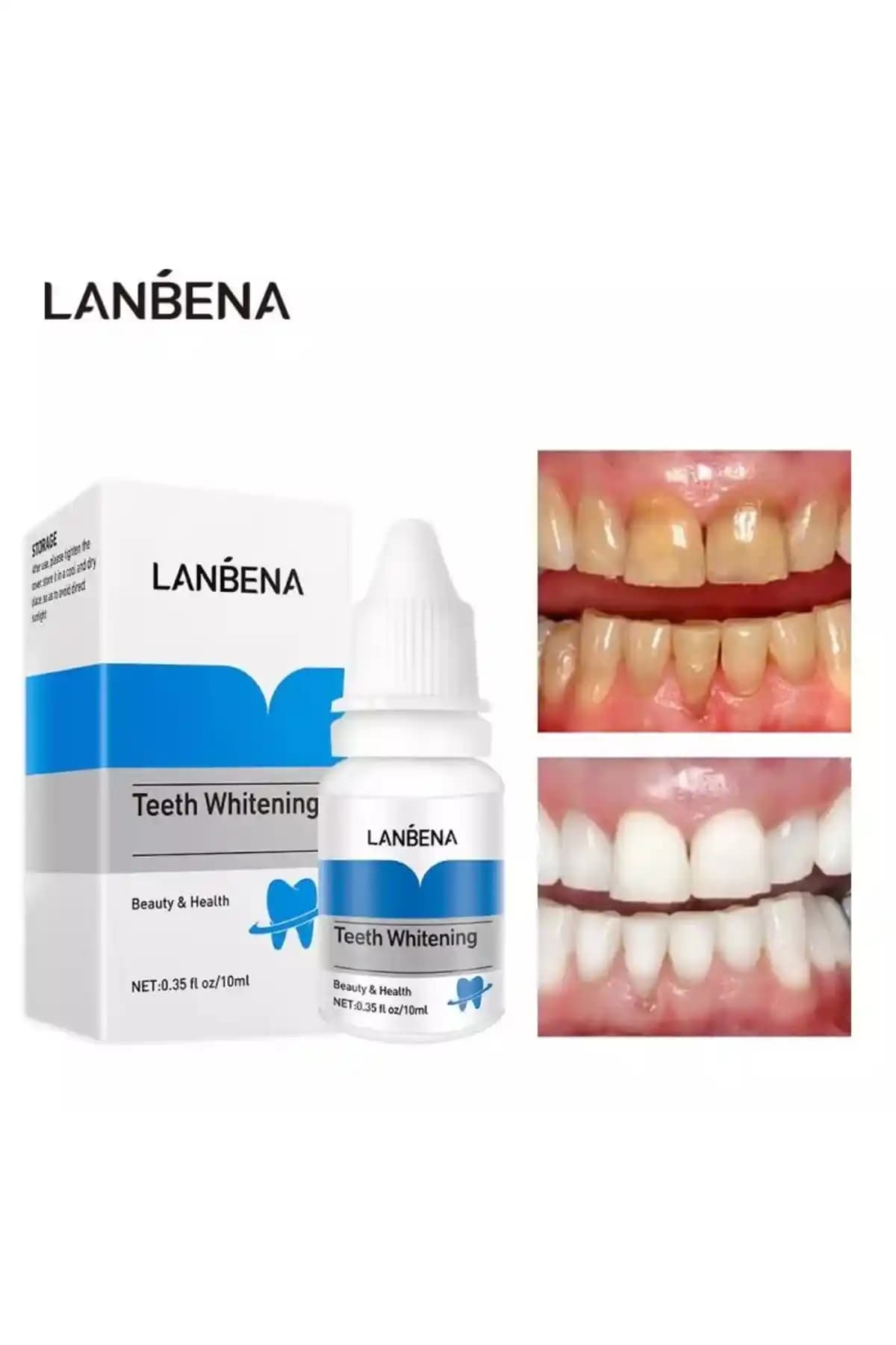 Genel Markalar ® Diş Plağı Temizleme ve Beyazlatma Seti İncelemesi ve Kullanım Detayları